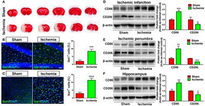 Glutaminase 1 Regulates Neuroinflammation After Cerebral Ischemia Through Enhancing Microglial Activation and Pro-Inflammatory Exosome Release